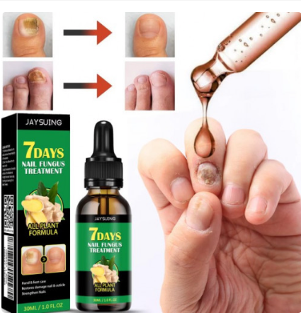 JAYSUING-7 DAYS TRATAMIENTO PARA HONGOS EN UÑAS Y PIES
